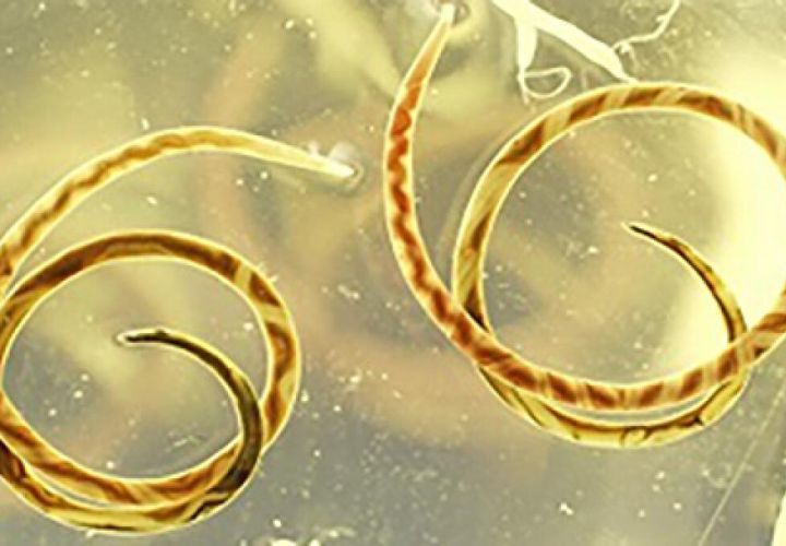 圣地亚哥首次发现食脑寄生虫 - 鼠肺线虫