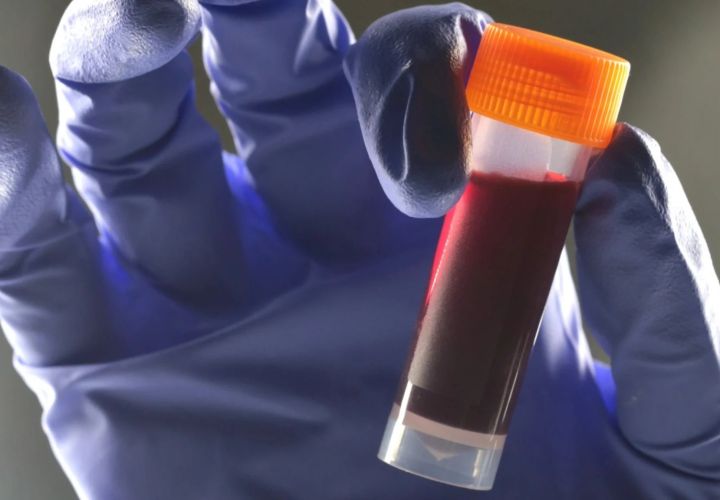 研究发现：B型血人群患2型糖尿病的风险或更高